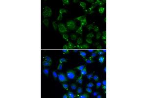 Immunofluorescence analysis of HeLa cell using MAPRE2 antibody. (MAPRE2 anticorps)