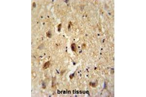 VITRN antibody (C-term) immunohistochemistry analysis in formalin fixed and paraffin embedded human brain tissue followed by peroxidase conjugation of the secondary antibody and DAB staining.