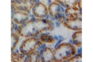 Used in DAB staining on fromalin fixed paraffin-embedded Kidney tissue