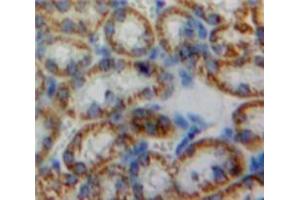 Used in DAB staining on fromalin fixed paraffin-embedded Kidney tissue (HMOX2 anticorps  (AA 71-306))