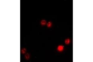 Immunofluorescent analysis of BAF53B staining in A549 cells.