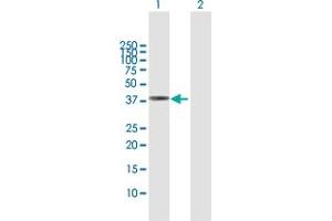 Western Blot analysis of PECI expression in transfected 293T cell line by PECI MaxPab polyclonal antibody.