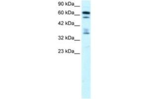 Western Blotting (WB) image for anti-Zinc Finger Protein 512 (ZNF512) antibody (ABIN2460159) (ZNF512 anticorps)