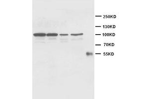 Western Blotting (WB) image for anti-Cadherin 2 (CDH2) antibody (ABIN1105630) (N-Cadherin anticorps)