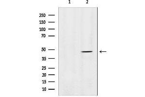 anti-Matrix Metallopeptidase 28 (MMP28) (Internal Region) antibody