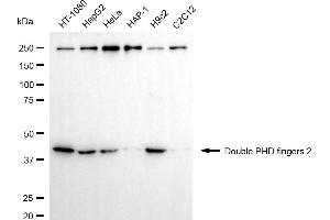 Western blotting analysis using double PHD fingers 2 antibody (ABIN7800901).