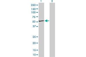 Western Blot analysis of ACADS expression in transfected 293T cell line by ACADS MaxPab polyclonal antibody.