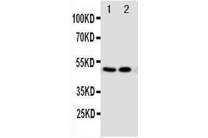Anti-Vitamin D Receptor antibody, Western blotting Lane 1: MCF-7 Cell Lysate Lane 2: HELA Cell Lysate