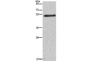 Western blot analysis of Human breast infiltrative duct tissue, using FOXC2 Polyclonal Antibody at dilution of 1:733 (FOXC2 anticorps)