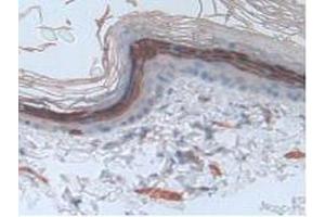 IHC-P analysis of Rat Skin Tissue, with DAB staining. (Involucrin anticorps  (AA 461-551))