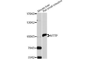 Western blot analysis of extracts of various cell lines, using MTTP antibody. (MTTP anticorps)