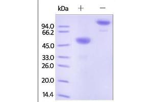 Human Ephrin-A1, Fc Tag on SDS-PAGE under reducing (R) and no-reducing (NR) conditions. (Ephrin A1 Protein (EFNA1) (AA 19-182) (Fc Tag))
