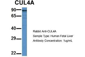 Host: Rabbit  Target Name: CUL4A  Sample Tissue: Human Fetal Liver  Antibody Dilution: 1.