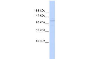 WB Suggested Anti-ST18 Antibody Titration:  0. (ST18 anticorps  (Middle Region))