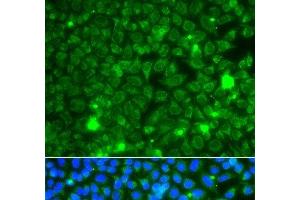Immunofluorescence analysis of A549 cells using GBA3 Polyclonal Antibody (GBA3 anticorps)