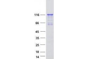 Validation with Western Blot