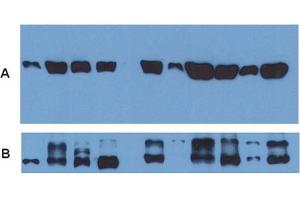 Use of alpha Tubulin monoclonal antibody, clone TU-01  as a loading control (A) in an Western blotting experiment revealing the staining pattern of various cell lysates by a newly developed monoclonal antibody (B). (alpha Tubulin anticorps)