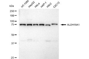 Western blotting analysis using ALDH16A1 antibody (ABIN7797562).
