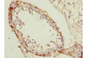 Immunohistochemistry of paraffin-embedded human testis tissue using ABIN7154259 at dilution of 1:100 (NMT2 anticorps  (AA 1-120))