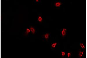 ABIN6269400 staining HeLa cells by IF/ICC. (HDAC6 anticorps  (N-Term))