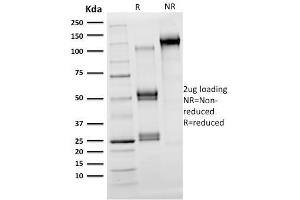 SDS-PAGE Analysis Purified OLIG2 Mouse Monoclonal Antibody (OLIG2/2400). (OLIG2 anticorps  (AA 1-141))