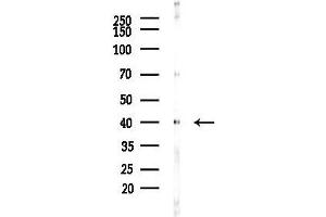 anti-Chemokine (C-X-C Motif) Receptor 1 (CXCR1) (N-Term) antibody