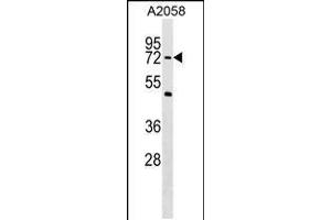 Western blot analysis in A2058 cell line lysates (35ug/lane). (PHF19 anticorps  (C-Term))