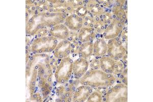 Immunohistochemistry of paraffin-embedded mouse kidney using C antibody (ABIN6127549, ABIN6137937, ABIN6137938 and ABIN6223226) at dilution of 1:100 (40x lens). (CARD10 anticorps  (AA 863-1032))