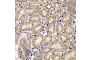 Immunohistochemistry of paraffin-embedded mouse kidney using C antibody (ABIN6127549, ABIN6137937, ABIN6137938 and ABIN6223226) at dilution of 1:100 (40x lens). (CARD10 anticorps  (AA 863-1032))