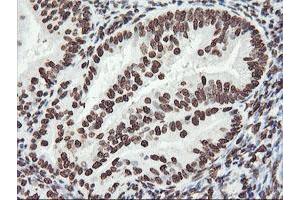 Image no. 3 for anti-F-Box Protein 21 (FBXO21) antibody (ABIN1498233) (FBXO21 anticorps)