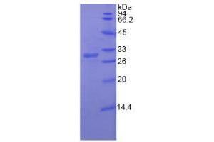 SDS-PAGE analysis of Human RIG1 Protein. (DDX58 Protéine)