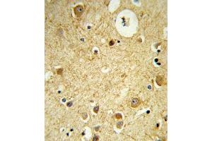 Formalin-fixed and paraffin-embedded human brain tissue reacted with RECK Antibody (Center), which was peroxidase-conjugated to the secondary antibody, followed by DAB staining. (RECK anticorps  (AA 430-456))