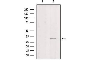 Western blot analysis of extracts from mouse brain, using ZNF498 Antibody. (Zinc Finger and SCAN Domain Containing 25 (ZSCAN25) anticorps)