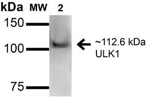 Western blot analysis of Human HeLa and 293Trap cell lysates showing detection of 112. (ULK1 anticorps  (AA 567-577) (APC))