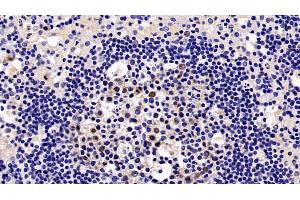 Detection of KPNa2 in Rat Lymph node Tissue using Polyclonal Antibody to Karyopherin Alpha 2 (KPNa2)