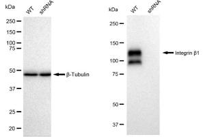 Western blotting analysis using Integrin beta 1 antibody (ABIN7799065).