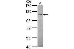 Retinoblastoma Binding Protein 8 anticorps  (Center)