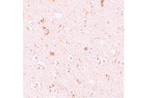 Immunohistochemical staining of human brain cells with SH3RF2 polyclonal antibody  at 10 ug/mL. (SH3RF2 anticorps  (C-Term))