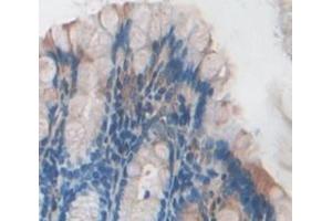 IHC-P analysis of Mouse Tissue, with DAB staining. (ITPA anticorps  (AA 2-198))