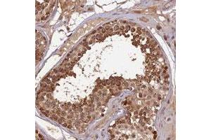 Immunohistochemical staining of human testis with RGL3 polyclonal antibody  shows strong cytoplasmic positivity in cells of seminiferus ducts. (RGL3 anticorps)