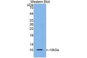 Detection of Recombinant CALY, Human using Polyclonal Antibody to Calcyon Neuron Specific Vesicular Protein (CALY) (CALY anticorps  (AA 1-63))