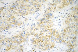 anti-Flotillin 1 (FLOT1) antibody