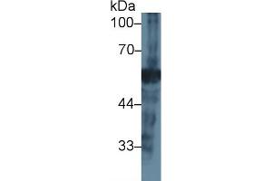 Detection of NEU in Mouse Pancreas lysate using Polyclonal Antibody to Neuraminidase (NEU) (NEU1 anticorps  (AA 47-415))