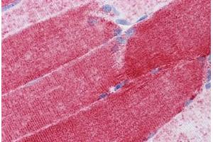 Human Skeletal muscle: Formalin-Fixed, Paraffin-Embedded (FFPE) (COX6B1 anticorps  (AA 1-87))