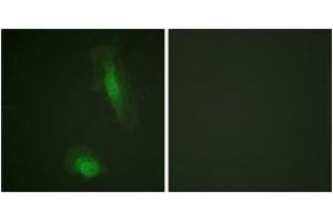 Immunofluorescence analysis of HeLa cells, using Akt (Ab-129) Antibody. (AKT1 anticorps  (AA 95-144))