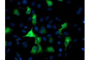 Anti-PFKP mouse monoclonal antibody (ABIN2455341) immunofluorescent staining of COS7 cells transiently transfected by pCMV6-ENTRY PFKP (RC200673). (PFKP anticorps)