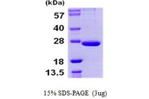 SDS-PAGE (SDS) image for Proteasome (Prosome, Macropain) Subunit, beta Type, 9 (Large Multifunctional Peptidase 2) (PSMB9) (AA 21-219) protein (His tag) (ABIN667409)