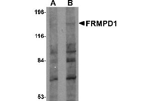 Western Blotting (WB) image for anti-FERM and PDZ Domain Containing 1 (FRMPD1) (C-Term) antibody (ABIN1030403) (FRMPD1 anticorps  (C-Term))