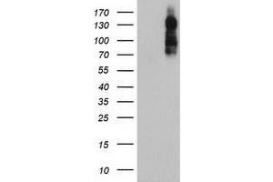 HEK293T cells were transfected with the pCMV6-ENTRY control (Left lane) or pCMV6-ENTRY ENPEP (Right lane) cDNA for 48 hrs and lysed. (ENPEP anticorps)