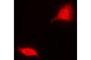 Immunofluorescent analysis of Aspartoacylase staining in MCF7 cells. (ASPA anticorps)